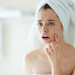 Acne Treatment & Care